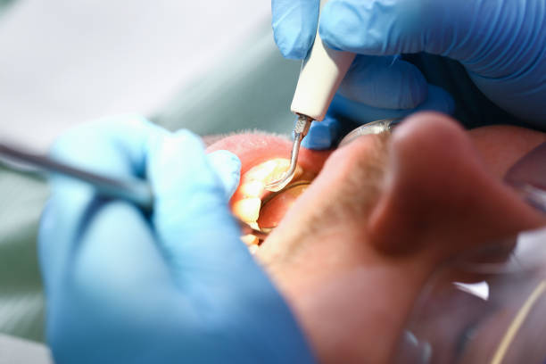 Best Emergency Dental Care for Abscessed Tooth in Great Neck Gardens, NY